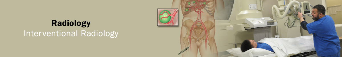 放射介入放射学横幅图像